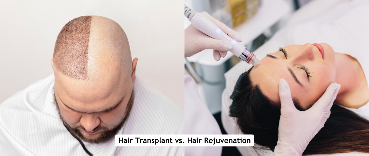 Hair Transplant