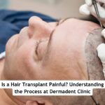 Hair Transplant