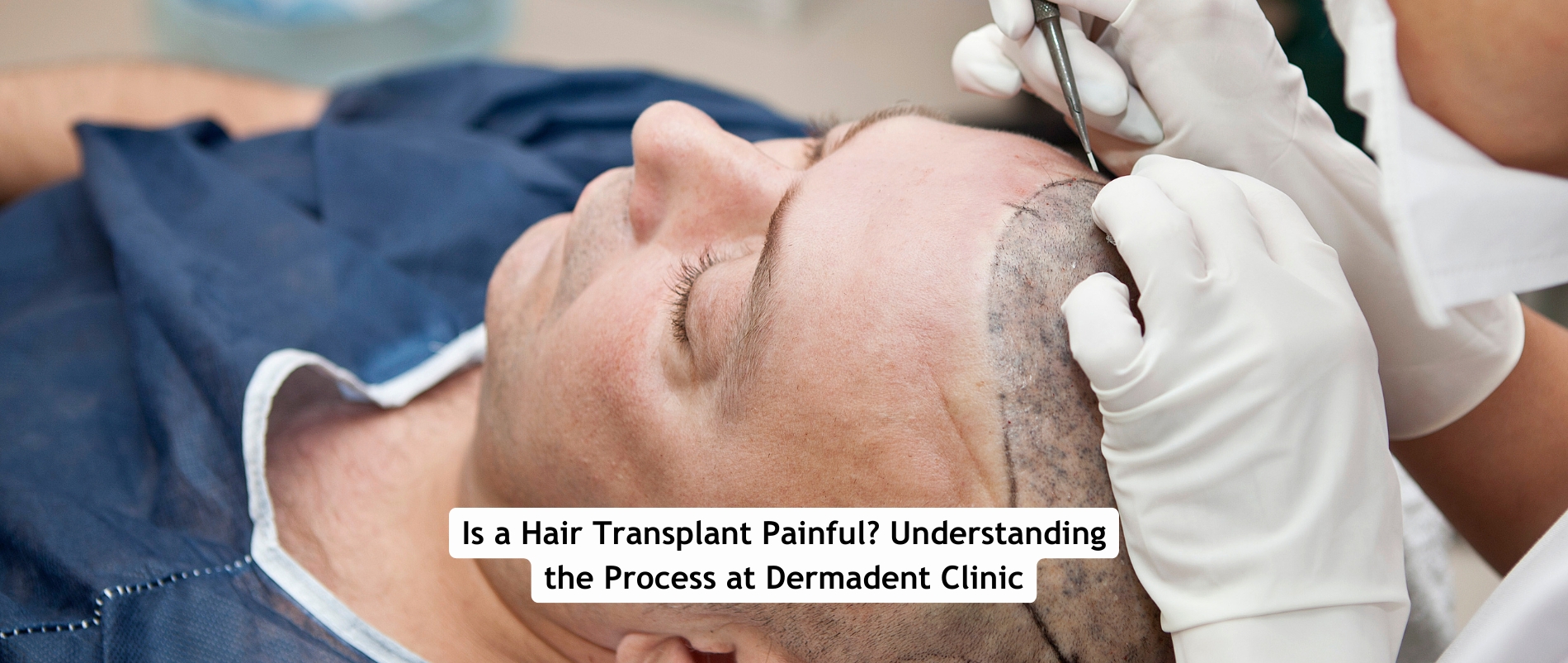 Hair Transplant