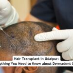 Hair Transplant in Udaipur